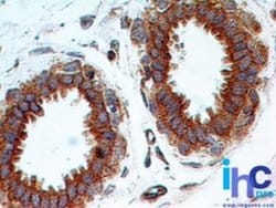 TLR2 Antibody (67N17F8) - Azide and BSA Free, Novus Biologicals 0.1 mg;